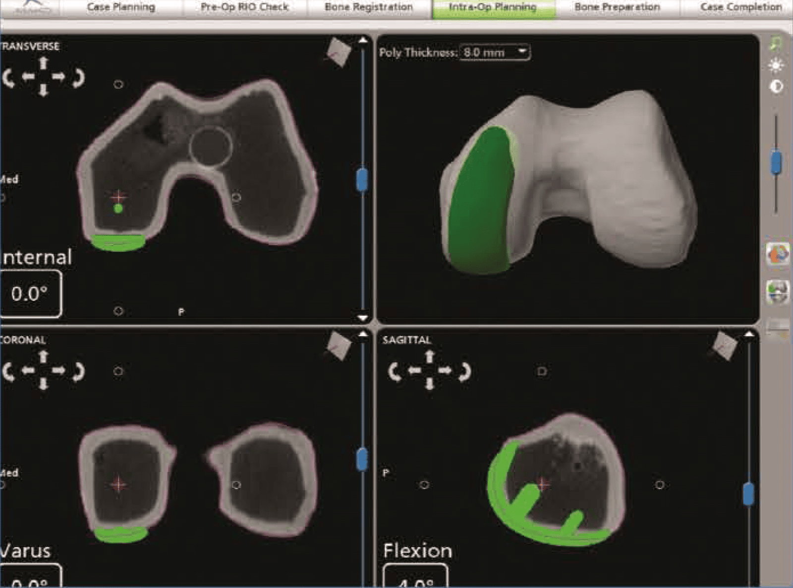 In the operating room
